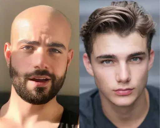 a bald and hairy head person