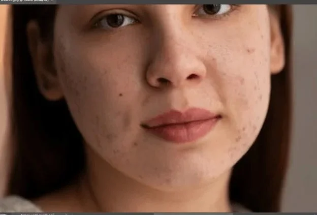 Spot Healing Brush Tool