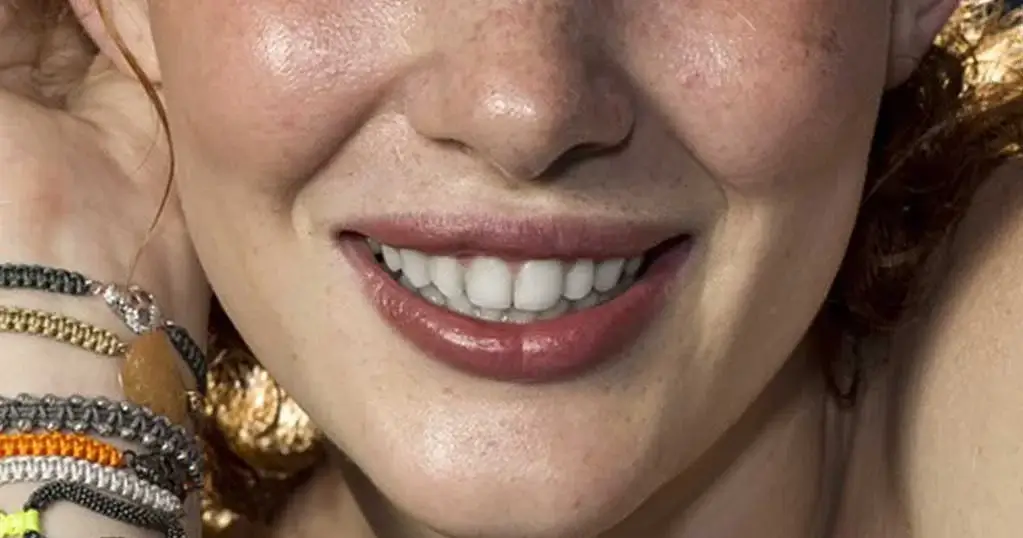final output of teeth whitening in photoshop