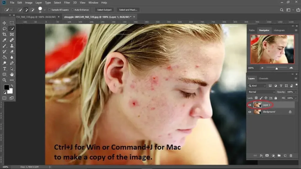 add image for removing blemishes from photos