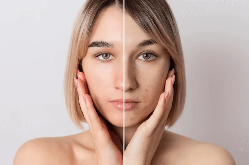 dust photo removal